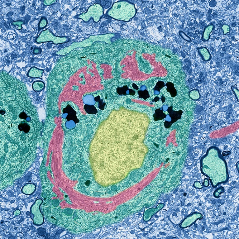 Neurone et complexe protéinique inhabituel