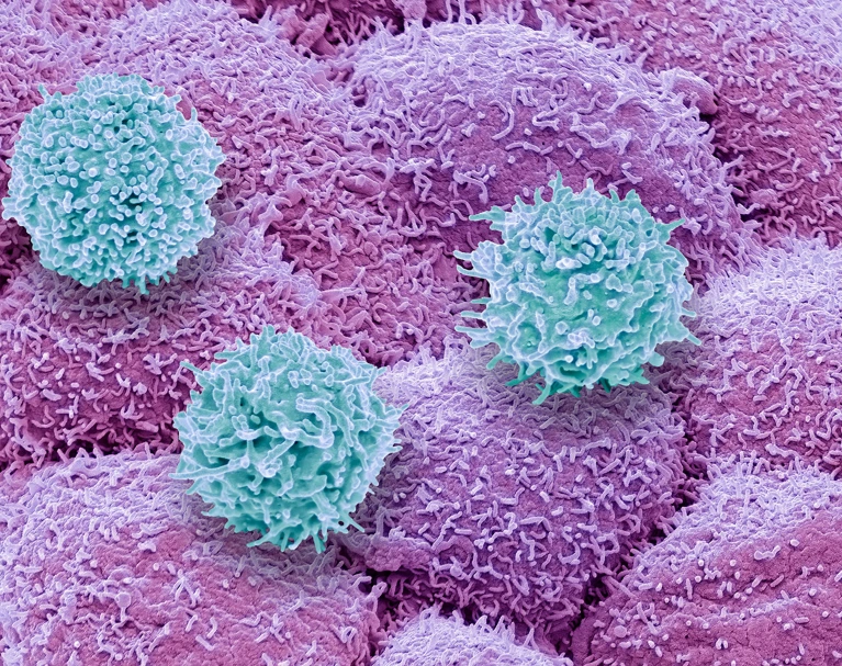 T cells prostate cancer