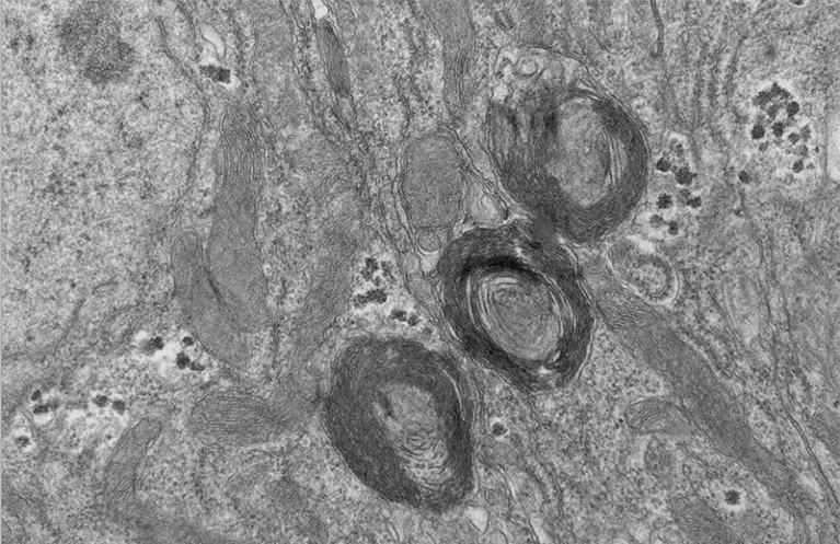 New phosphate sensing organelle Nature 2023 05 03